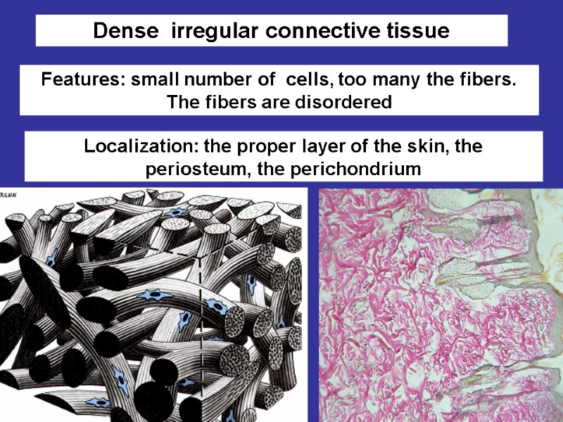 Плотная волокнистая неоформленная Features: small number of  cells, too many the fibers. The